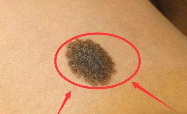 7c988070424cf2e2b28a5efe4095da0b 拷贝 7c988070424cf2e2b28a5efe4095da0b 拷贝