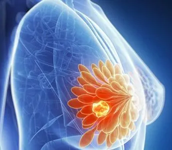 乳腺晚期前的症状