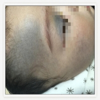 太田痣，你又知多少