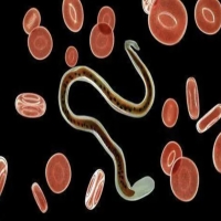 乳腺疾病的几大谣言，你居然都信了