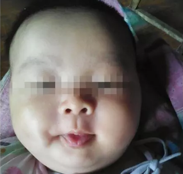 治疗结束