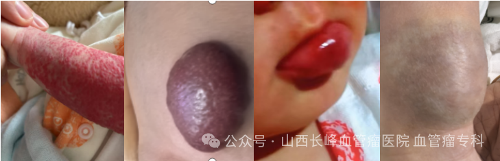 5575178dde70151475c3068210bf79a5.png