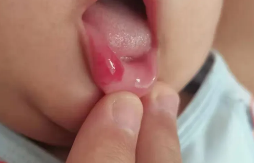 遇到这种情况，家长应该怎么处理呢？