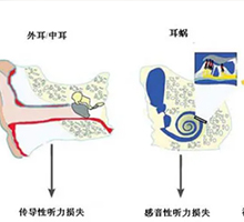 你要知道，颈部血管瘤有这些危害