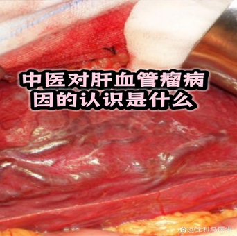 肝血管瘤是良性肿瘤，不预示癌症，绝大多数不用治，定期复查就行。