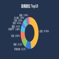 黑色素瘤上热搜 这样的痣要当心
