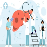 肝血管瘤：是“定时炸弹”还是“纸老虎”？科学认识与应对策略